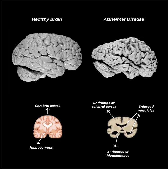 brain-visualisation