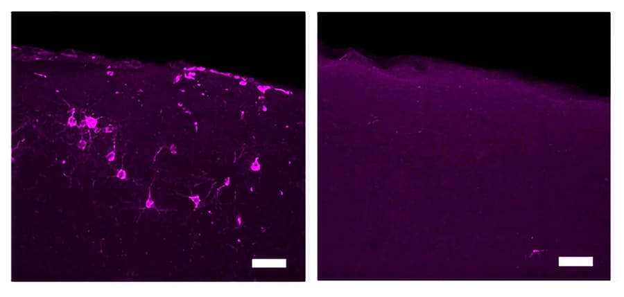 mit-study-light-therapy-dementia