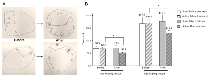 research-alzheimer-light