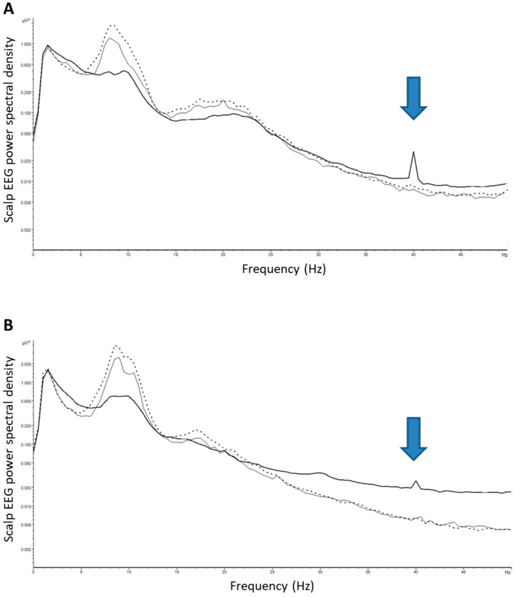 research-data-light-therapy-for-cognitive-decline