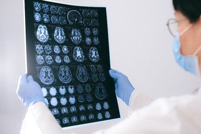 a-doctor-studying-brain-scans-for-brain-exercises-to-prevent-alzheimers